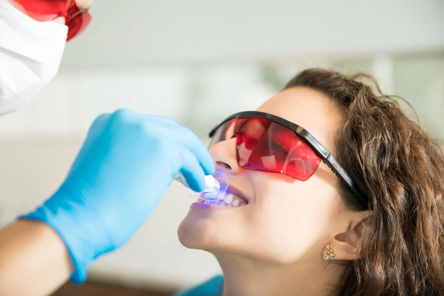 Clareamento Dental em Ouro Preto BH - Tratare Odontologia