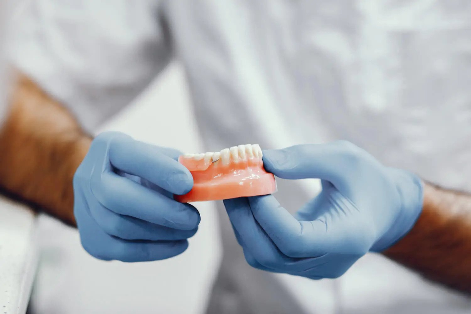 Reabilitação Oral em Ouro Preto BH - Tratare Odontologia