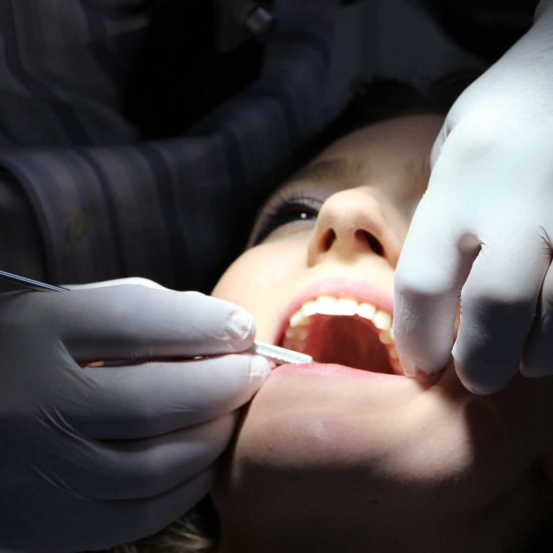 Tratamento de Canal em Ouro Preto BH - Tratare Odontologia