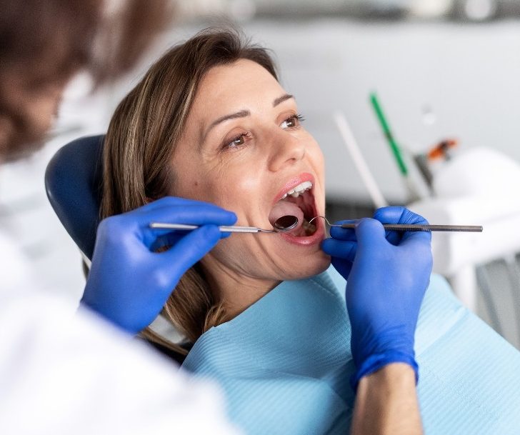Tratamento de Gengiva em Ouro Preto BH - Tratare Odontologia